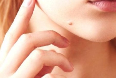 شخصیت شناسی خال صورت و بدن